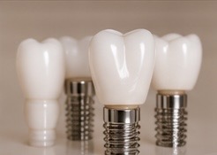 Fogászati implantátum